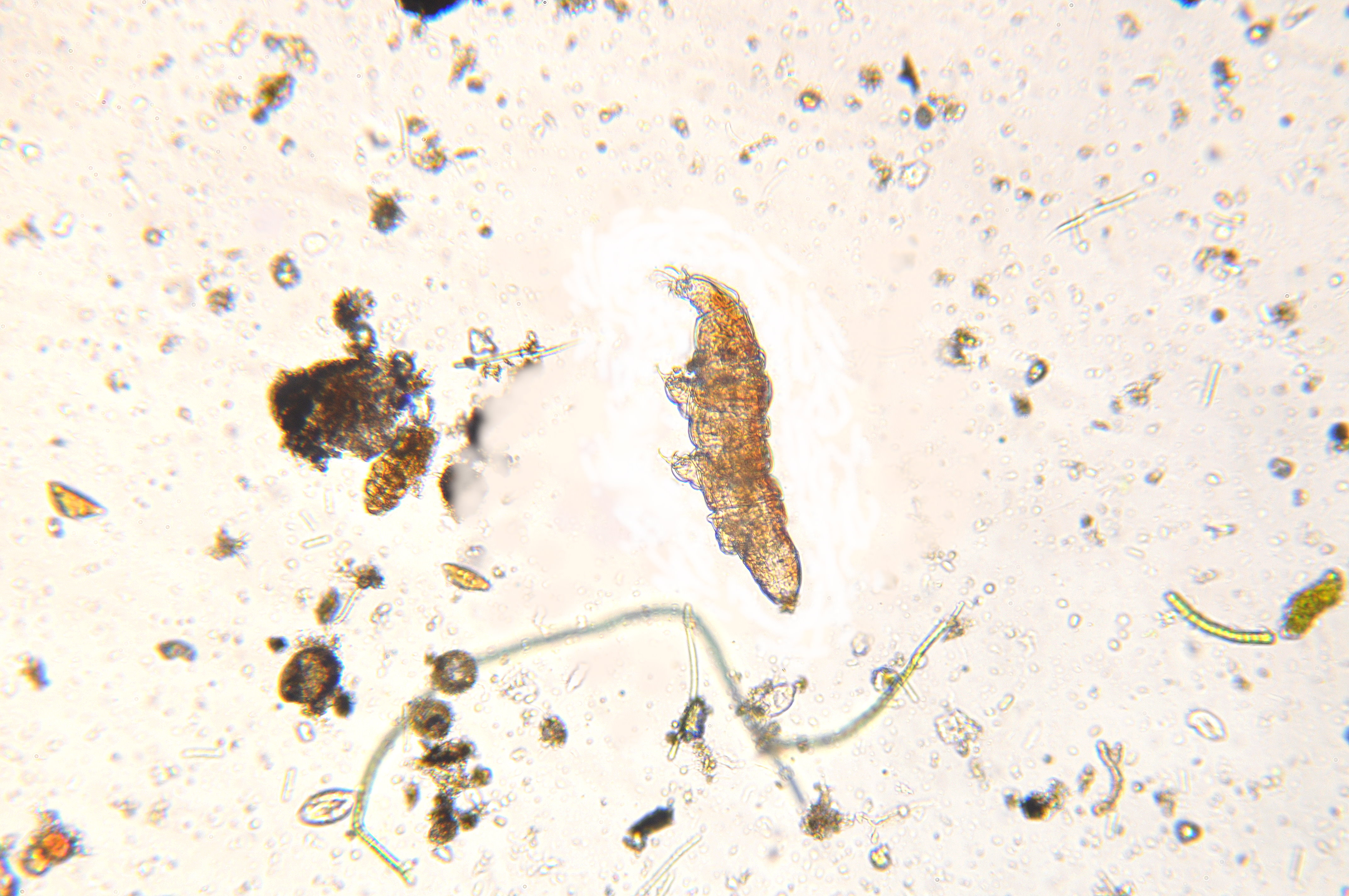 Bärtierchen (Stamm Tardigrada) aus einem Moosposter auf der Nordseite des Hausdaches (Mikroskopfotografie)